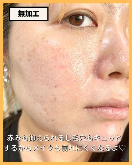 Icywhite /imbue/その他スキンケアを使ったクチコミ(4枚目)