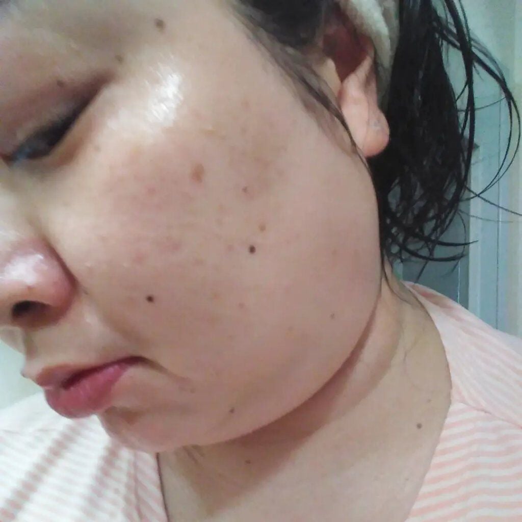 ビューティーオープナージェル/オージオ/オールインワン化粧品を使ったクチコミ(5枚目)