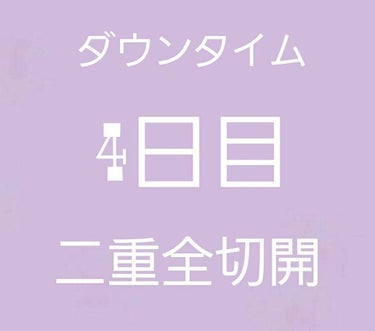 二重整形/その他を使ったクチコミ（1枚目）