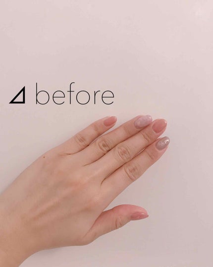 薬用ホワイトコンク ホワイトニングCC CII/ホワイトコンク/ボディクリームを使ったクチコミ(2枚目)