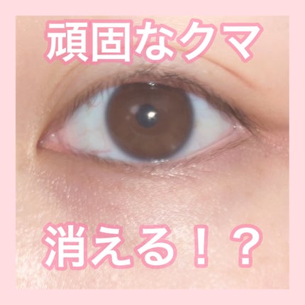トーンパーフェクティング パレット/DECORTÉ/パレットコンシーラーを使ったクチコミ(1枚目)