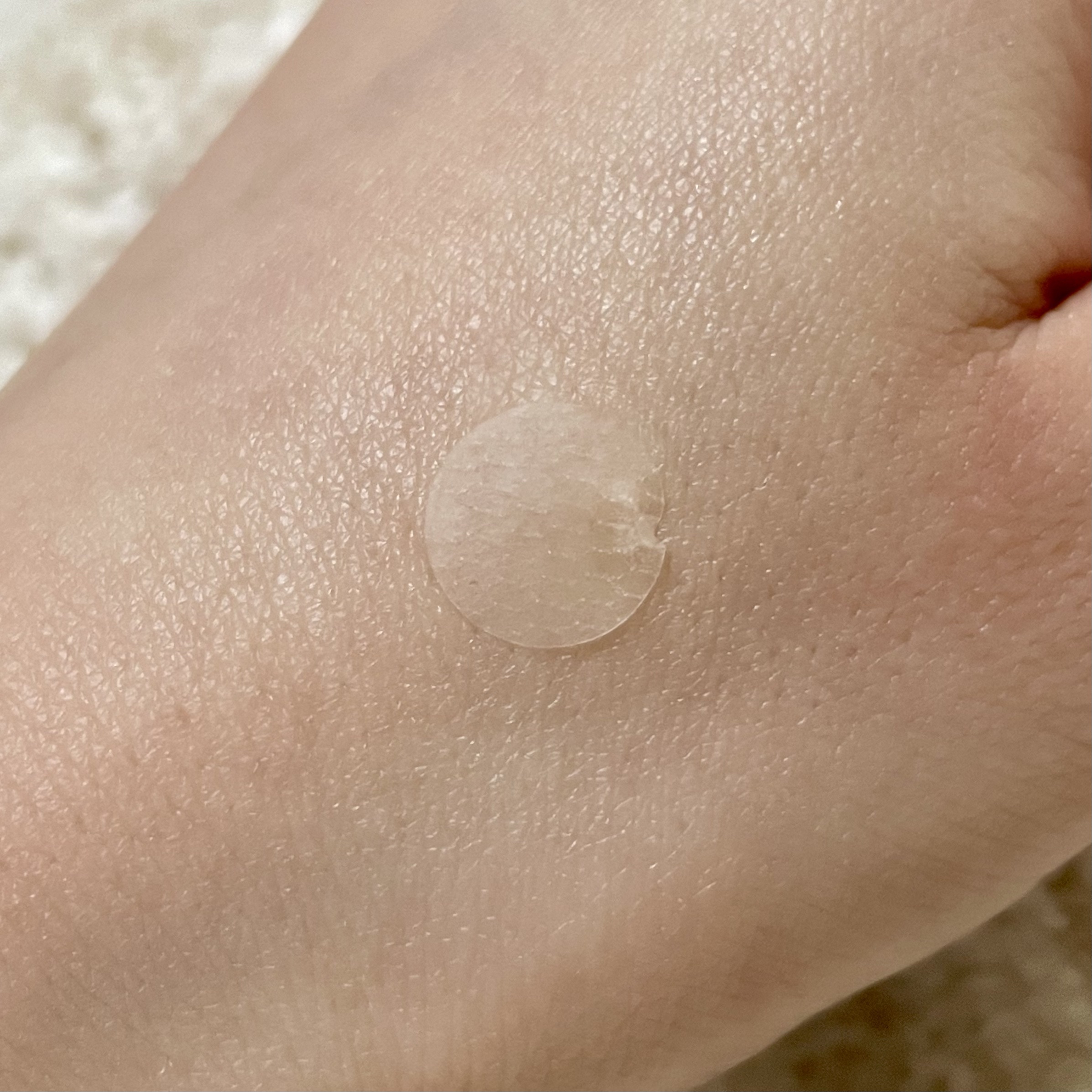 SPOT PATCH ロールタイプ/Shupong/にきびパッチを使ったクチコミ（3枚目）