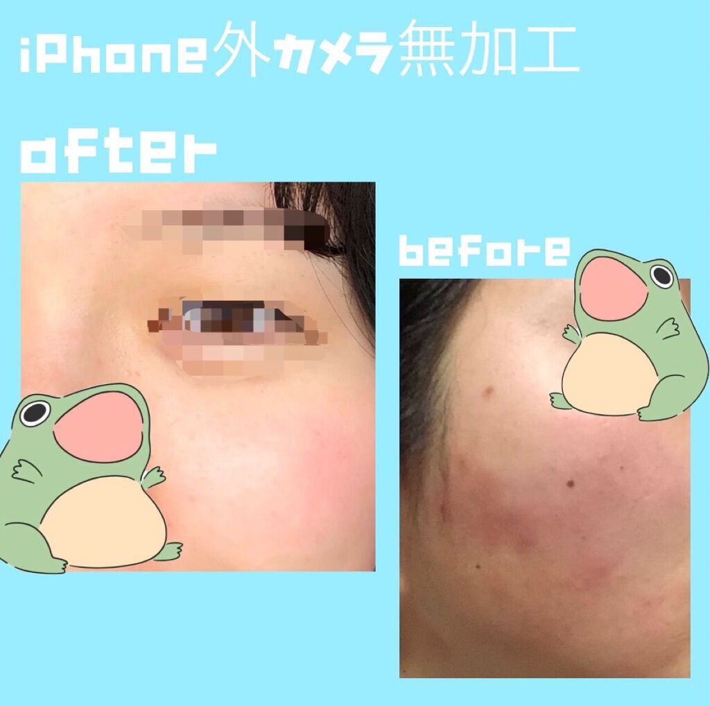 DHC ビタミンCハードカプセル/DHC/美容サプリメントを使ったクチコミ(1枚目)