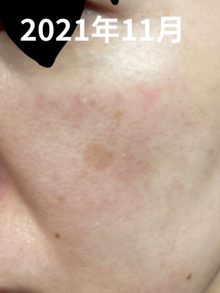 オルビス ユードット ローション/オルビス/化粧水を使ったクチコミ(2枚目)