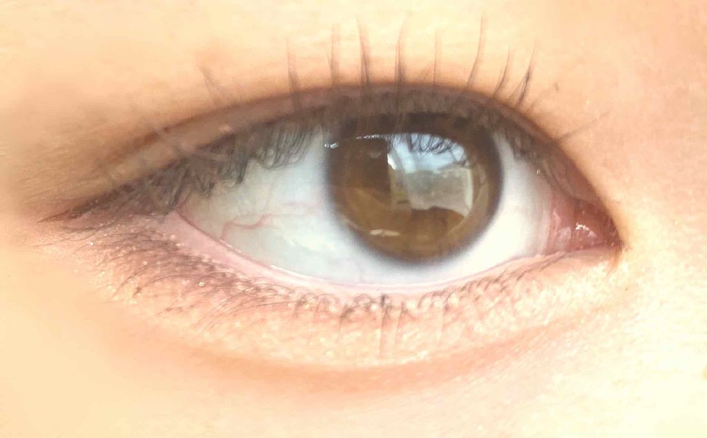 アイビューティー フィクサー WP/アストレア ヴィルゴ/二重まぶた用アイテムを使ったクチコミ（3枚目）