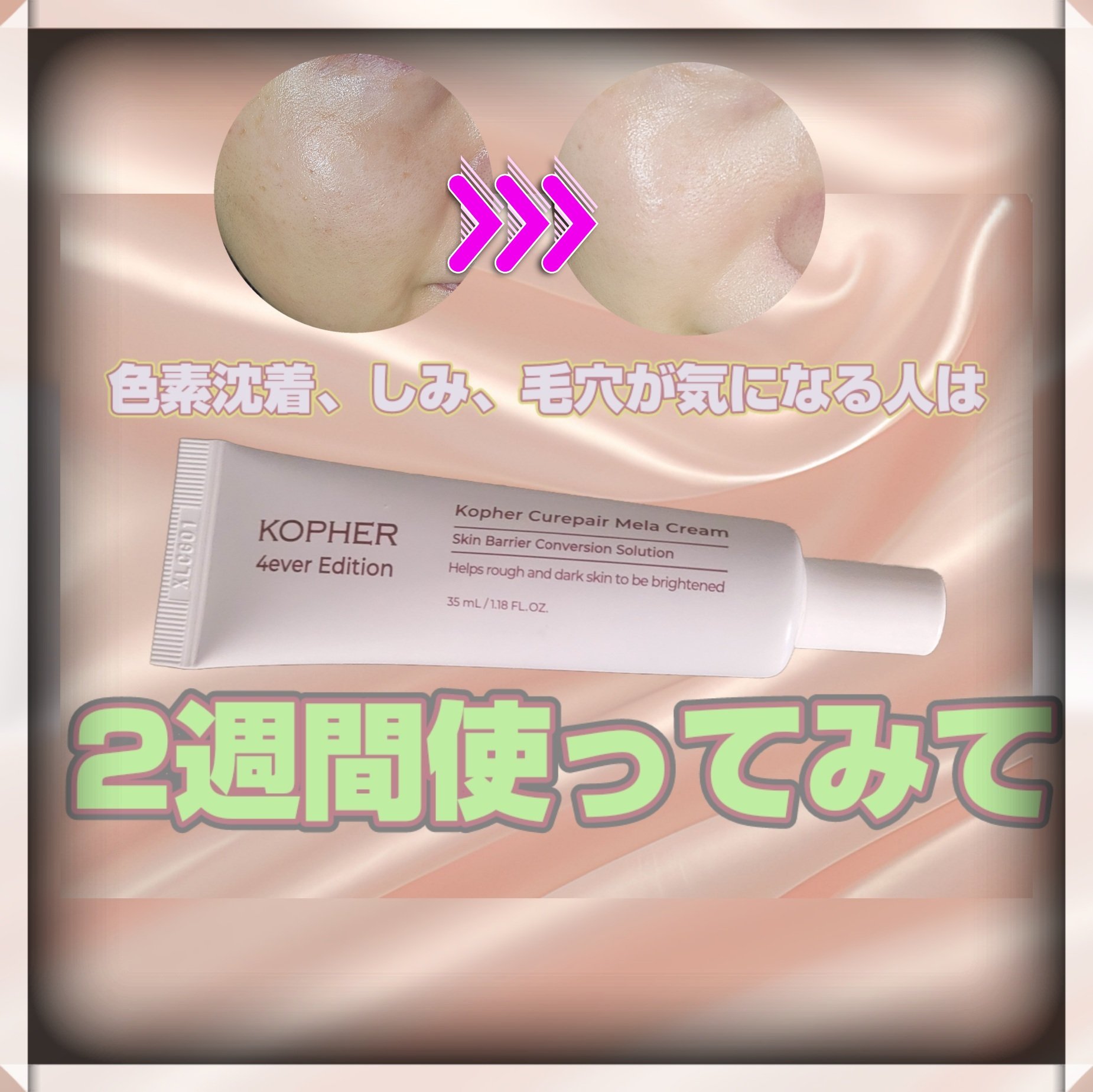 CUREPAIR MELA CREAM /KOPHER/フェイスクリームを使ったクチコミ（1枚目）
