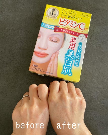 クリアターン ホワイト マスク (ビタミンC)/クリアターン/シートマスク・パックを使ったクチコミ(4枚目)