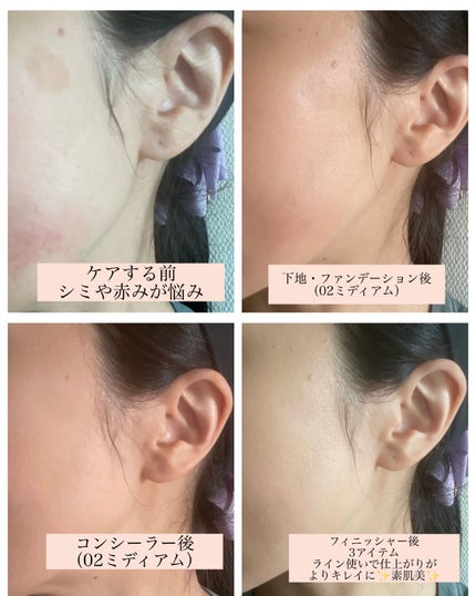 RIKA on LIPS 「コスメラウンジの企画で、アルブランさんから商品を提供いただきま..」(6枚目)