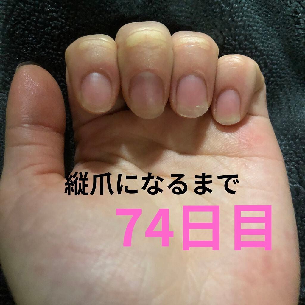 ð on LIPS ã瞊çªã«ãªãããã«ãããããªæ¹æ³ããã£ããæããŠãã ããð瞊çªã«..ãïŒ1æç®ïŒ