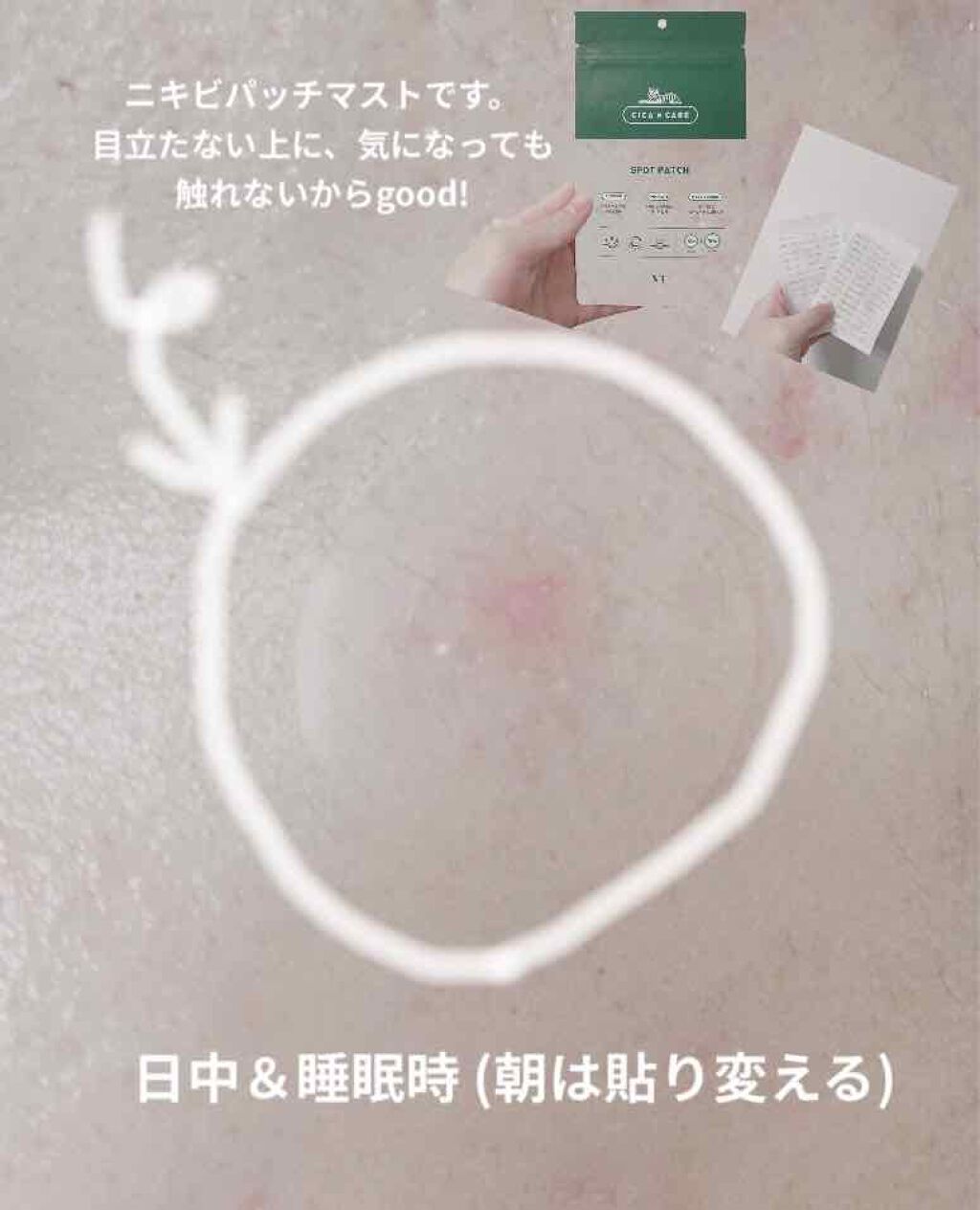 プロCICA クリアスポットパッチ/VT/その他スキンケアを使ったクチコミ(2枚目)