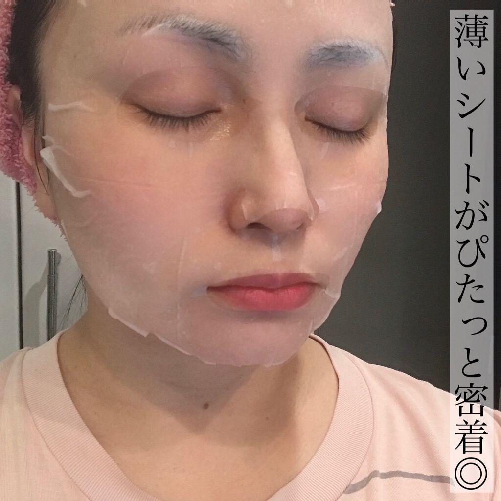 グリーン ダーマCICAビックトナー/ネイチャーリパブリック/化粧水を使ったクチコミ(10枚目)