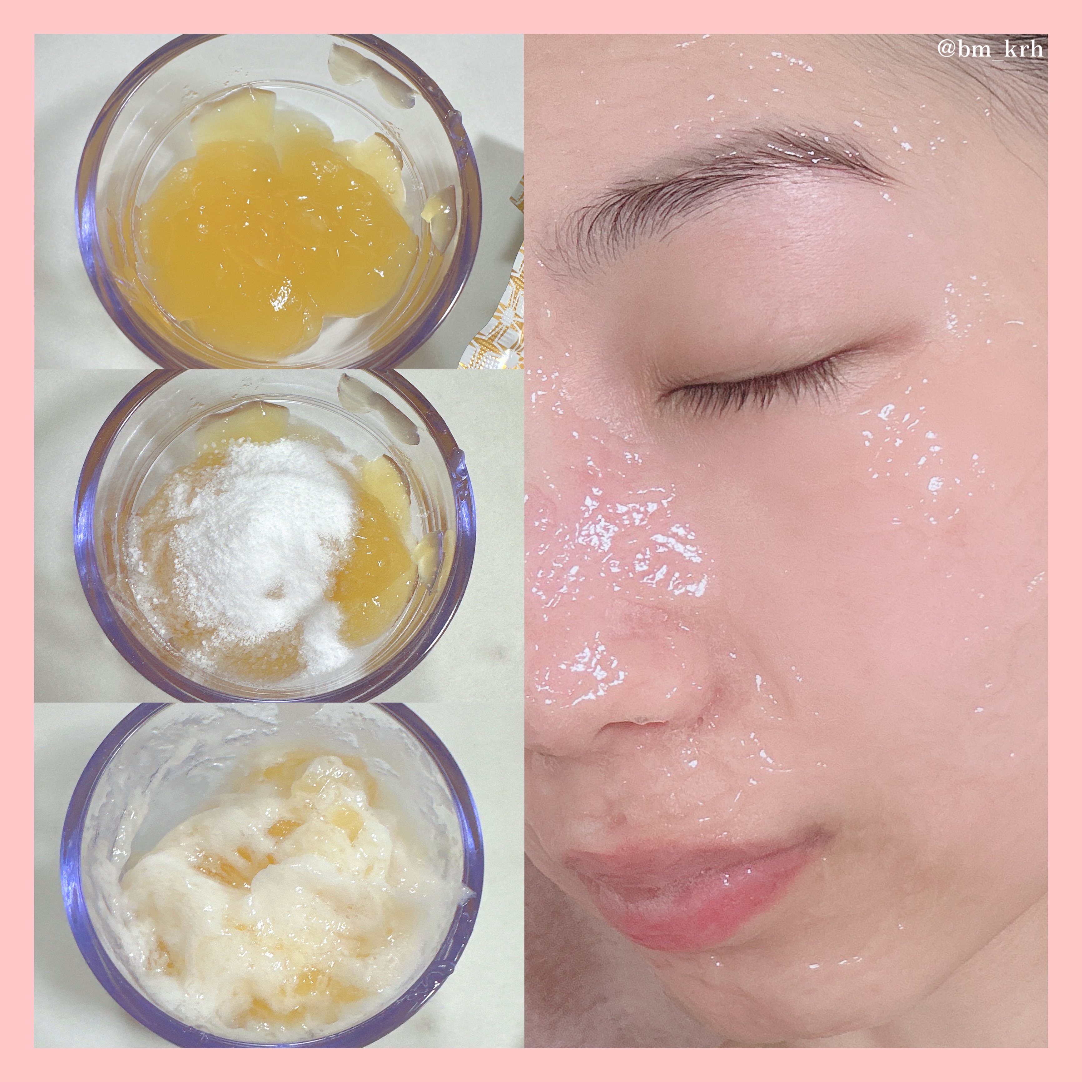 メディプローラー CO2ジェルマスク/ドクターメディオン/洗い流すパック・マスクを使ったクチコミ（2枚目）