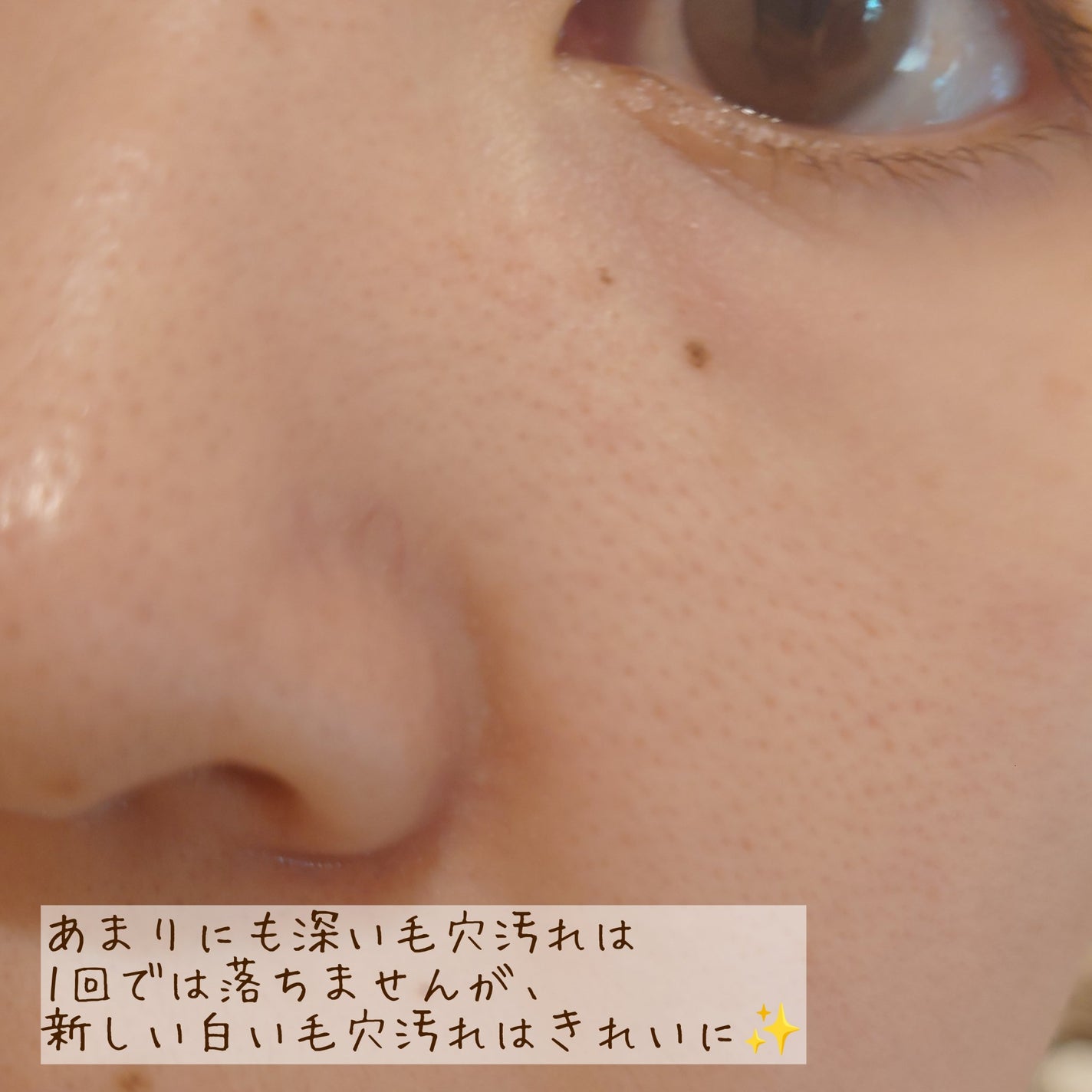 ブラックジェルクレンジング/.akaran/クレンジングジェルを使ったクチコミ(4枚目)