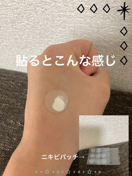 薬用ニキビケア スポッツクリーム/アクネスラボ/フェイスクリームを使ったクチコミ(3枚目)