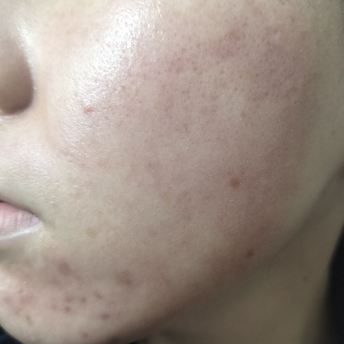 パイオネックス/セイリン/その他を使ったクチコミ(2枚目)