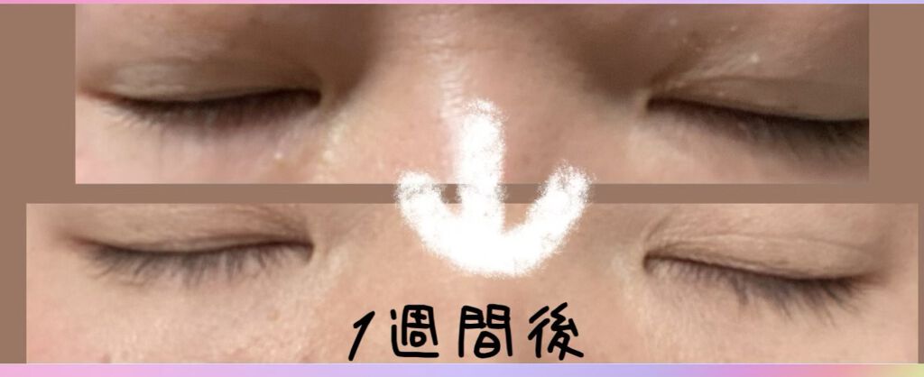 EMAKED（エマーキット）/水橋保寿堂製薬/まつげ美容液を使ったクチコミ（3枚目）