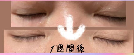 EMAKED(エマーキット)/水橋保寿堂製薬/まつげ美容液を使ったクチコミ(3枚目)