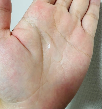 ãšã€ã·ã«365ãã€ã¯ãã»ã©ã /AESTURA/çŸå®¹æ¶²ã䜿ã£ãã¯ãã³ãïŒ2æç®ïŒ