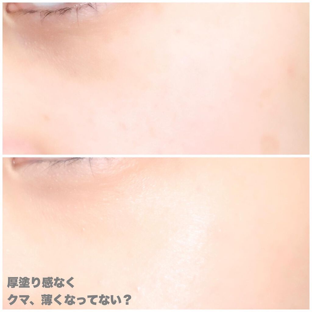 &be ファンシーラー/&be/パレットコンシーラーを使ったクチコミ(7枚目)