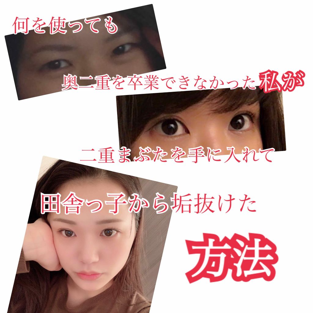 ふたえテープ 目立たず肌になじむ絆創膏タイプ/DAISO/二重まぶた用アイテムを使ったクチコミ(1枚目)