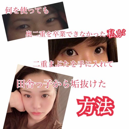 ふたえテープ 目立たず肌になじむ絆創膏タイプ/DAISO/二重まぶた用アイテムを使ったクチコミ(1枚目)