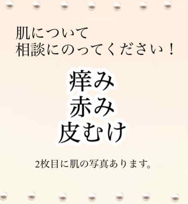 みぃぽな on LIPS 「【大至急！！お肌について】アトピー持ちの、敏感・乾燥肌です。今..」（1枚目）