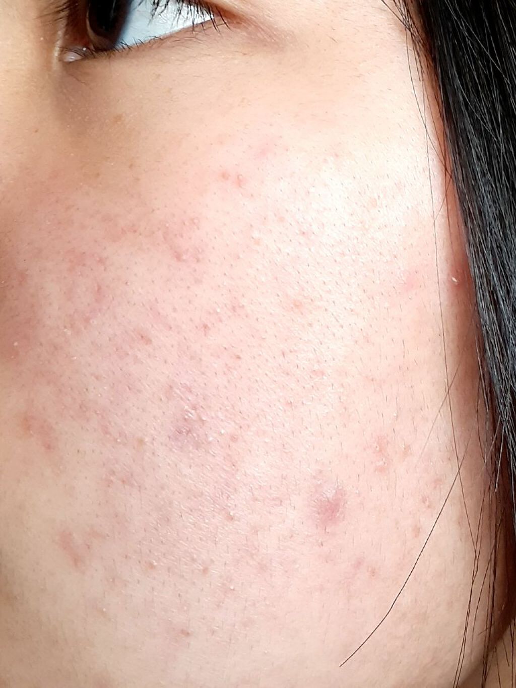 明色美顔水 薬用化粧水/美顔/化粧水を使ったクチコミ(1枚目)