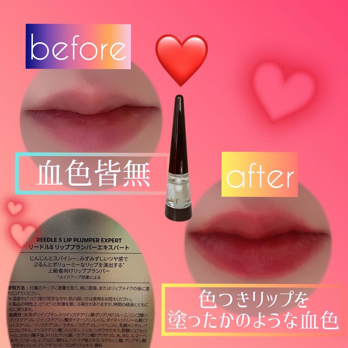 リードルS リッププランパーエキスパート/VT/リッププランパーを使ったクチコミ（2枚目）