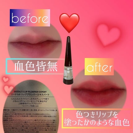 リードルS リッププランパーエキスパート/VT/リッププランパーを使ったクチコミ(2枚目)