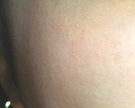 ドラマティックパウダリー UV/マキアージュ/パウダーファンデーションを使ったクチコミ(1枚目)