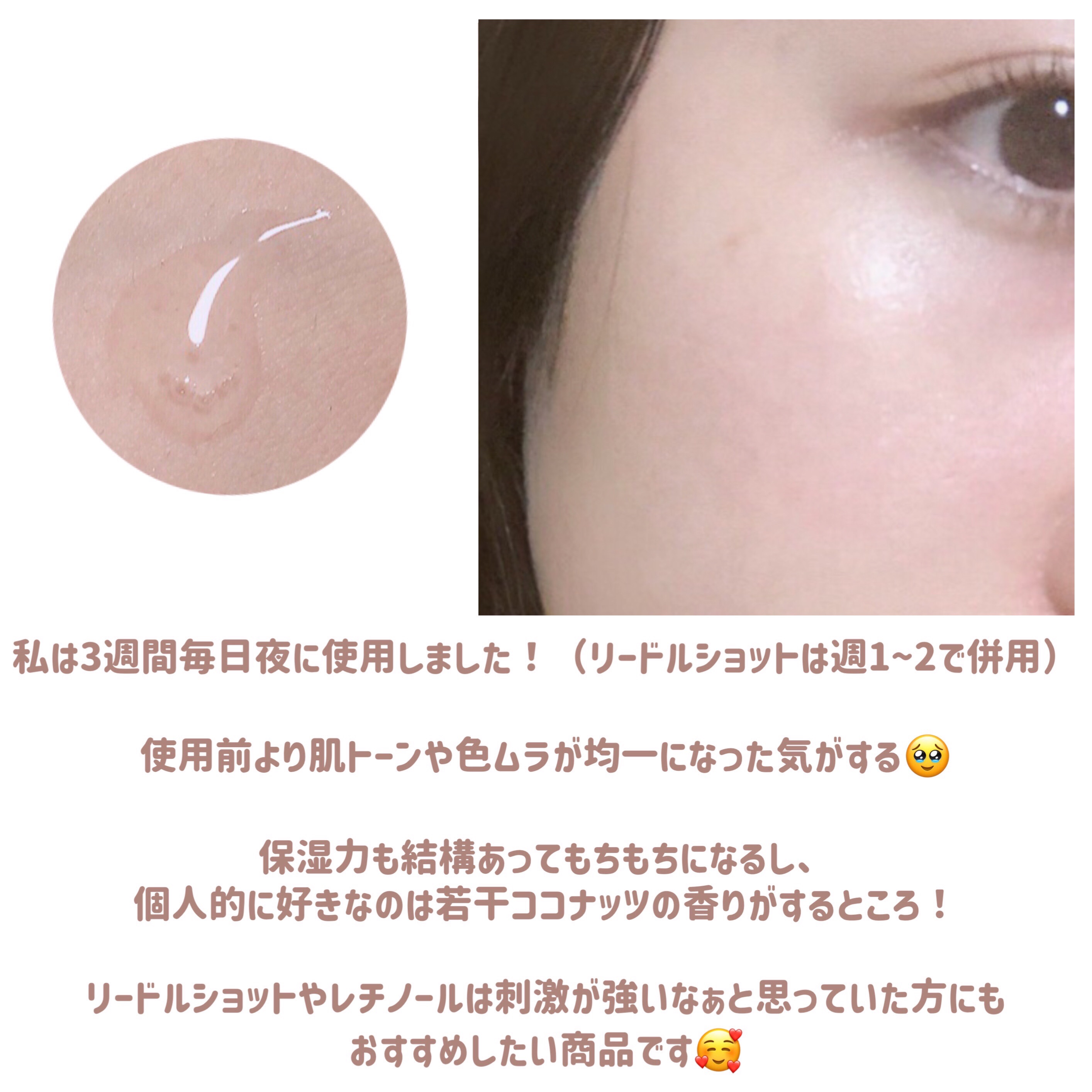 TXトーニングエッセンス1000SHOT/VT/美容液を使ったクチコミ（3枚目）