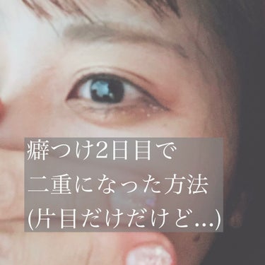 こんにちは〜💭
今回は私が癖つけ2日目で二重になった方法をお教えします！
※2日目で二重になったのは左目のみです。
※もちろん個人差はありますし、私はこの方法でなりました。というだけの記事です。

私も