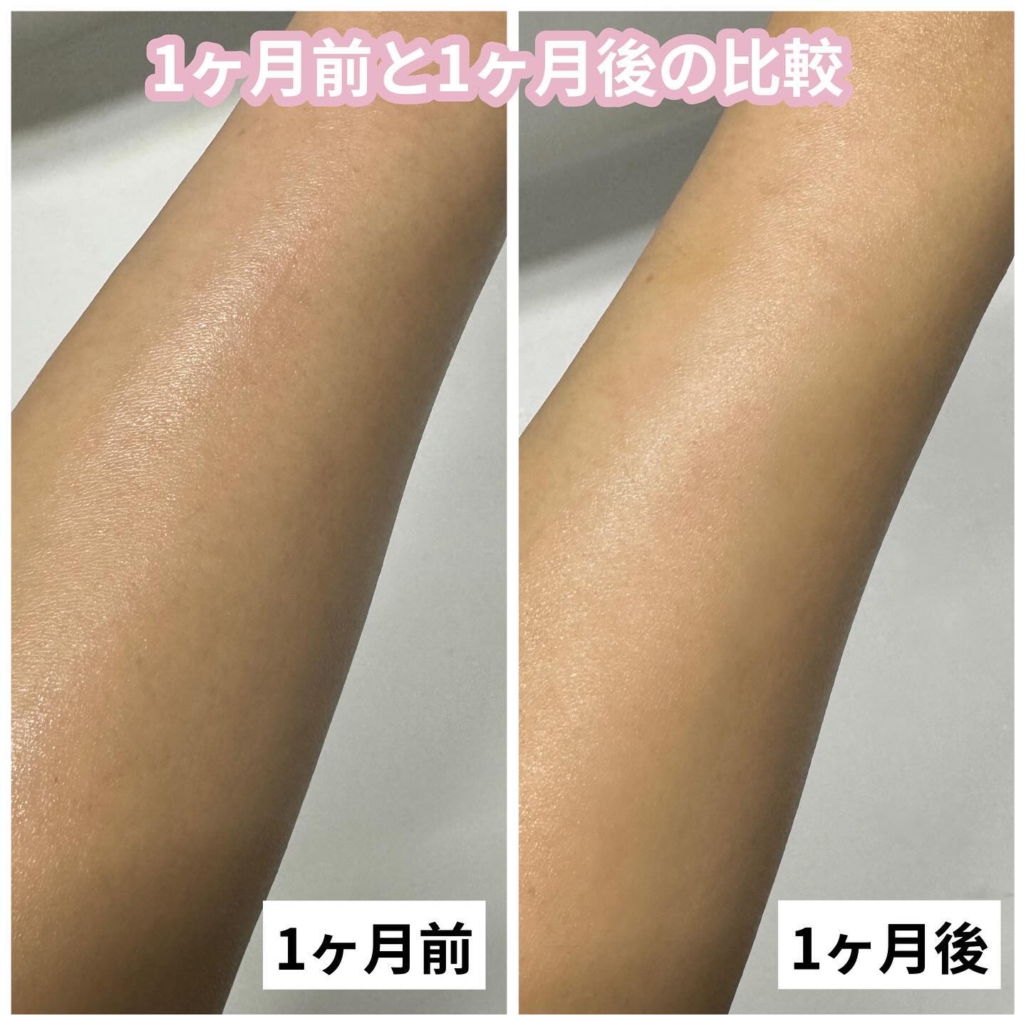 薬用美白WHITE+AIDe/Nalelu(ナレル)/フェイスクリームを使ったクチコミ（3枚目）