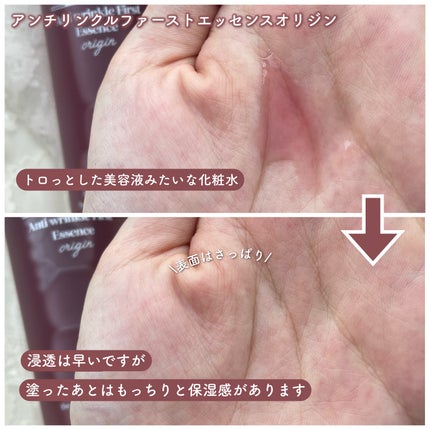 アンチリンクルエフェクトアンプルオリジン/MIGUHARA/美容液を使ったクチコミ(4枚目)