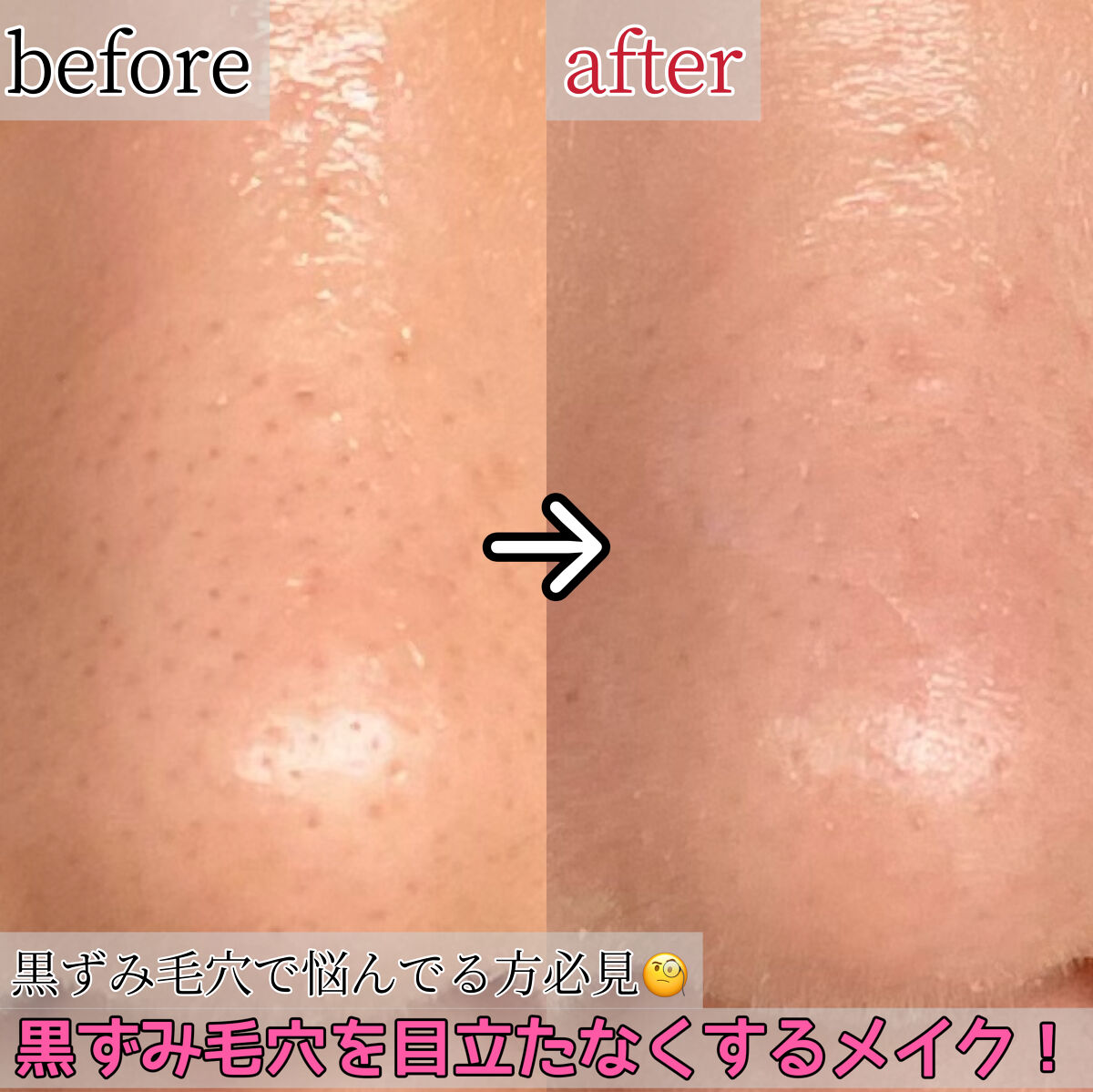 毛穴レスコンシーラー/CEZANNE/クリームコンシーラーを使ったクチコミ（1枚目）