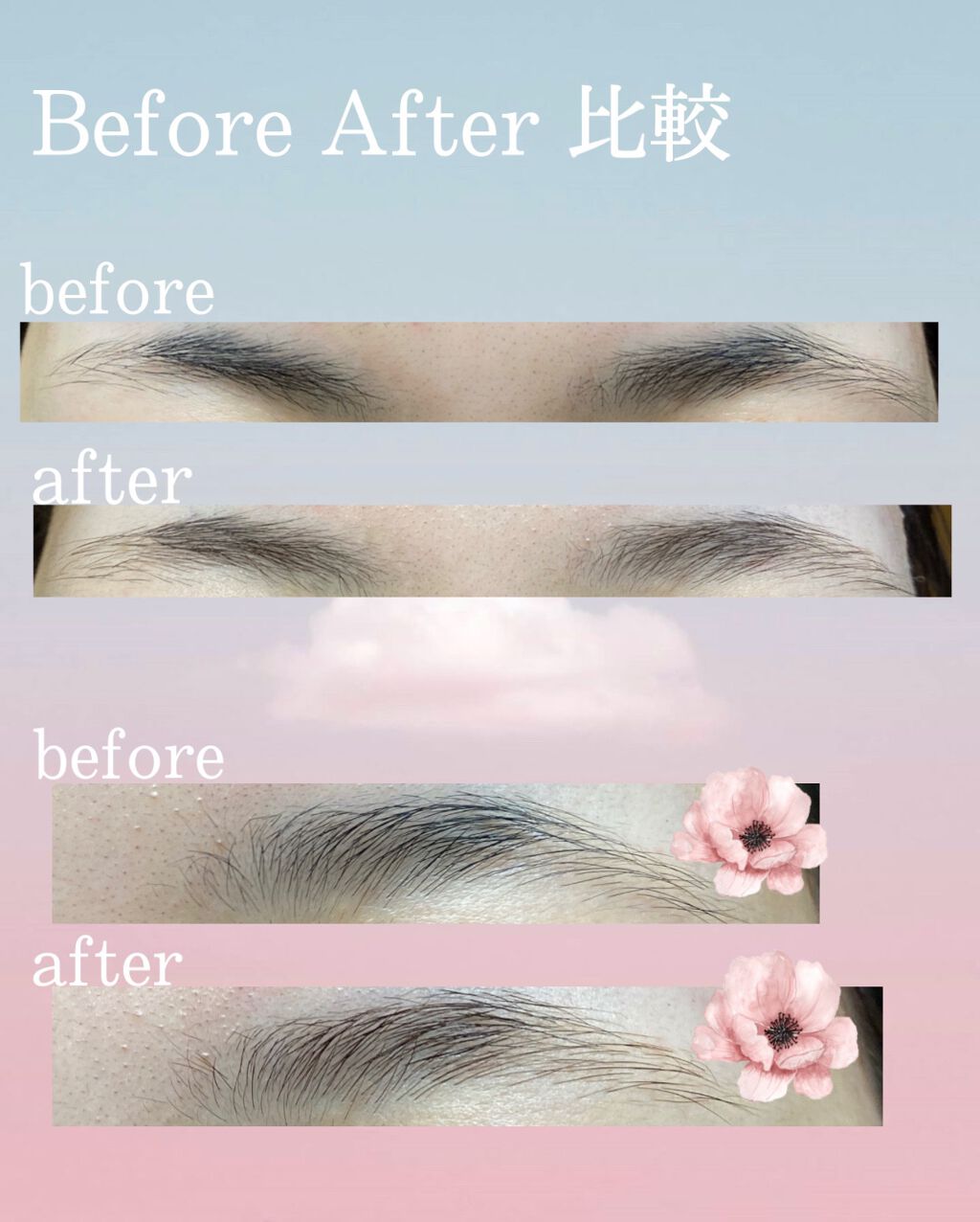 脱色クリーム 敏感肌用/エピラット/ムダ毛ケアを使ったクチコミ(6枚目)