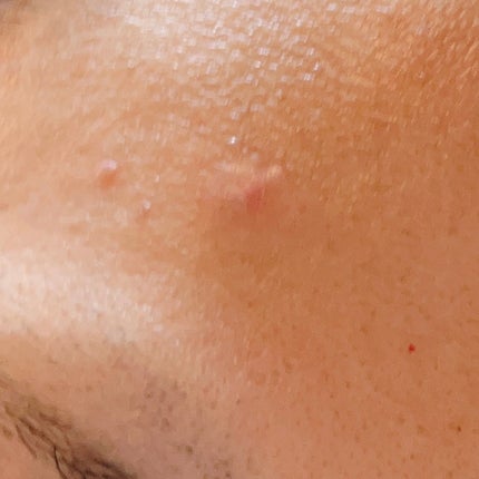 ごめんね素肌 キニシナイパッチ/クリアターン/シートマスク・パックを使ったクチコミ(3枚目)