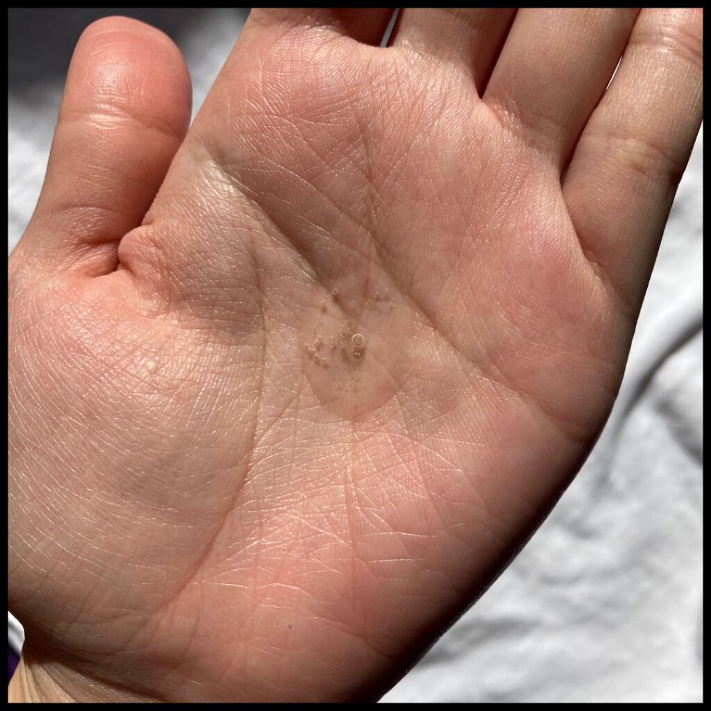 BHA ピーリングアンプル/beplain/美容液を使ったクチコミ(4枚目)