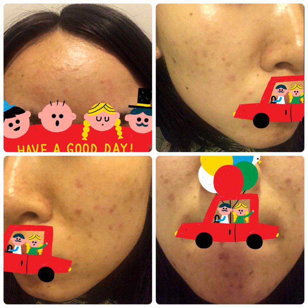 化粧水・敏感肌用・しっとりタイプ/無印良品/化粧水を使ったクチコミ（3枚目）