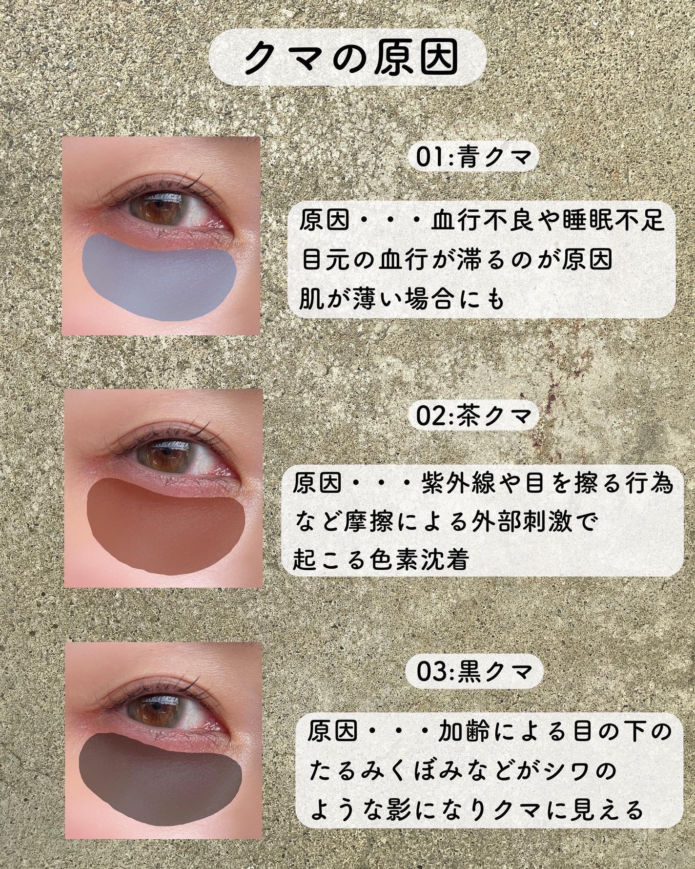 アンダーアイブライトナー/ケサランパサラン/パレットコンシーラーを使ったクチコミ(4枚目)