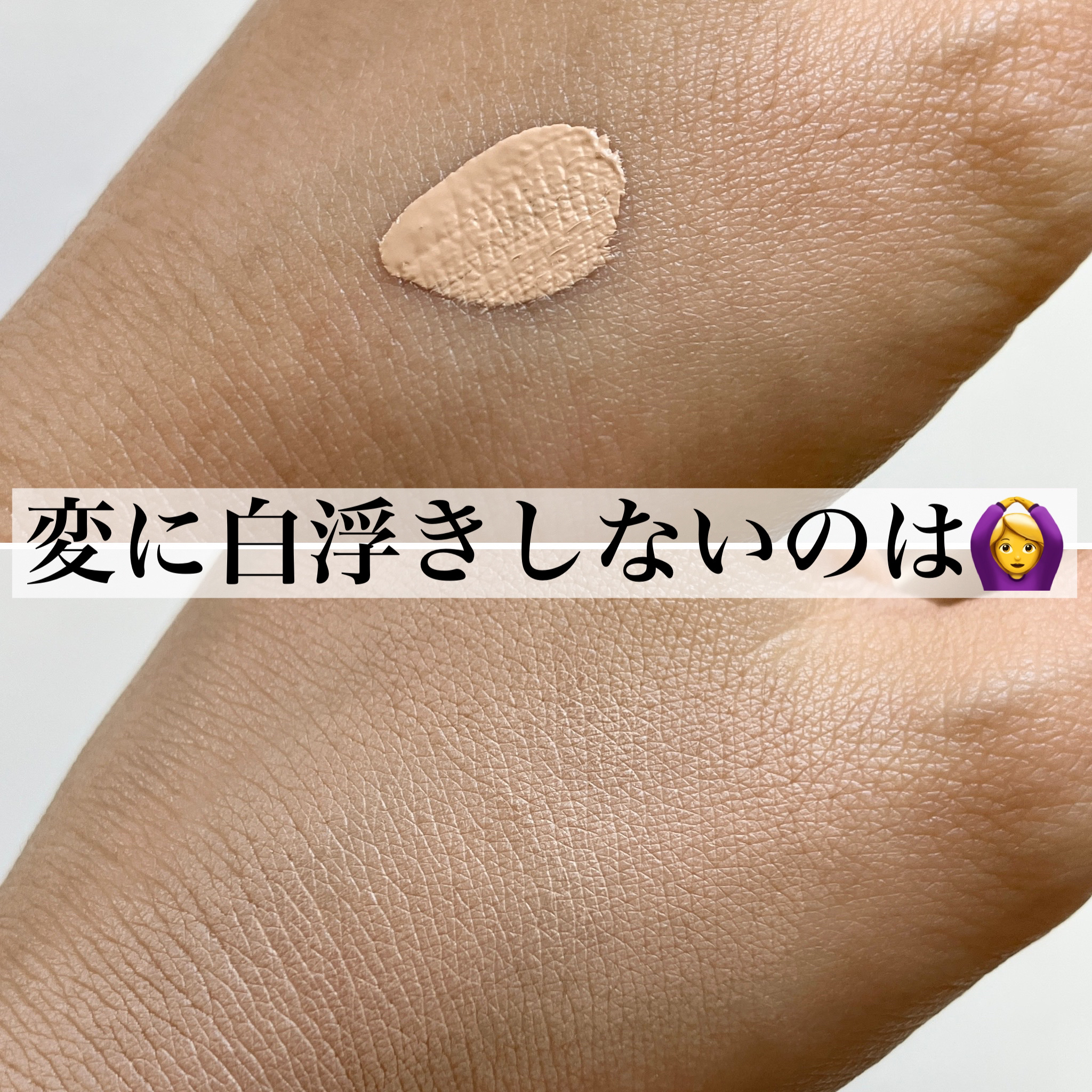 タトゥーウォータープルーフスカーコンシーラー/フォレンコス/リキッドコンシーラーを使ったクチコミ（2枚目）