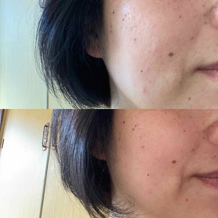 リンクル&ホワイト スキンパーフェクション ジェル/ミキモト コスメティックス/オールインワン化粧品を使ったクチコミ(2枚目)