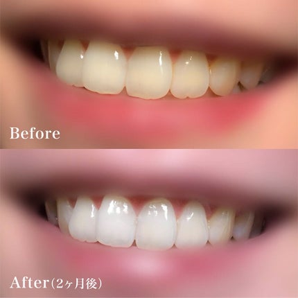 Lighteeハミガキ /ライオン/歯磨き粉を使ったクチコミ(3枚目)