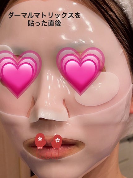 フェイシャルダーマルケアマスク Dermall matrix/Dermall matrix/シートマスク・パックを使ったクチコミ(2枚目)