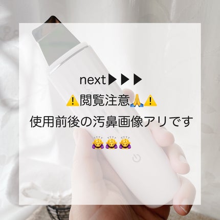 ウォーターピーリング超音波美顔器/ANLAN/美顔器・マッサージを使ったクチコミ(5枚目)