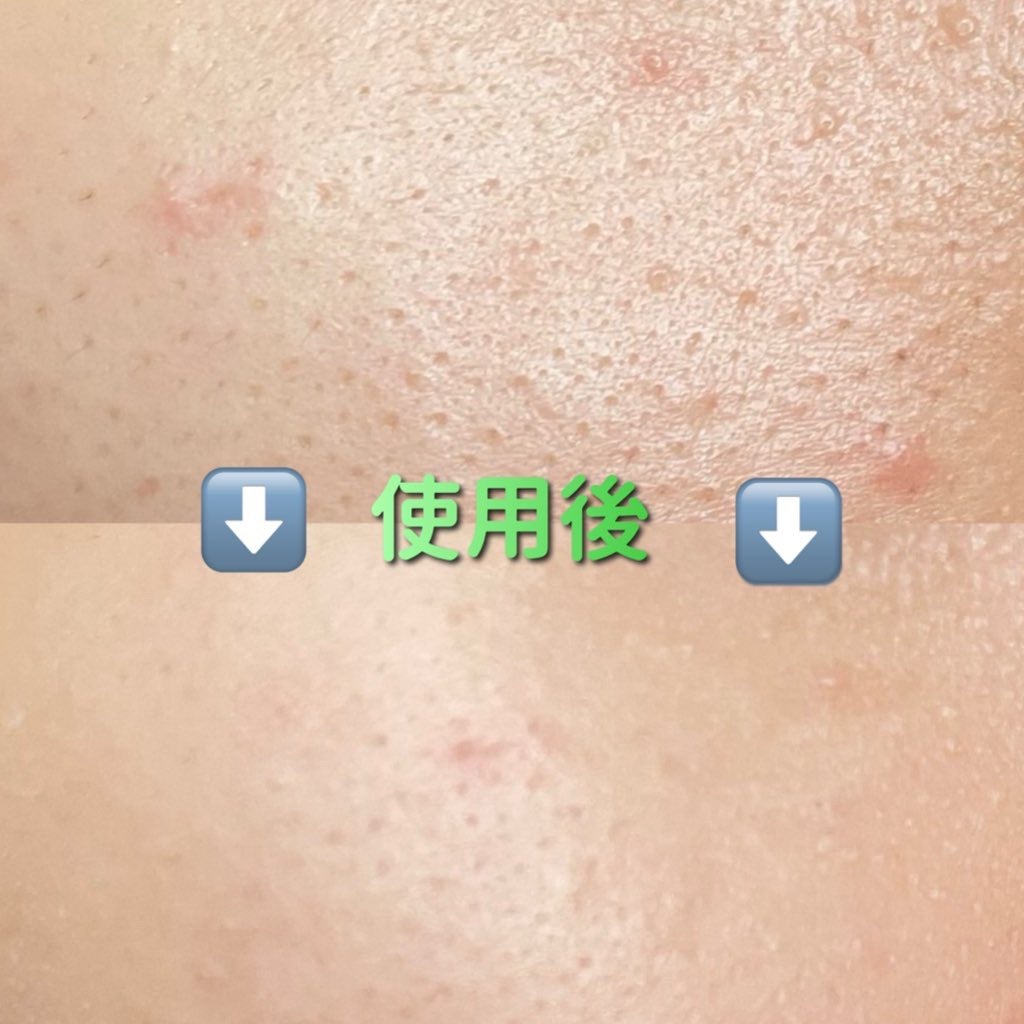 カラーセッティングベース/SELVE/化粧下地を使ったクチコミ(2枚目)