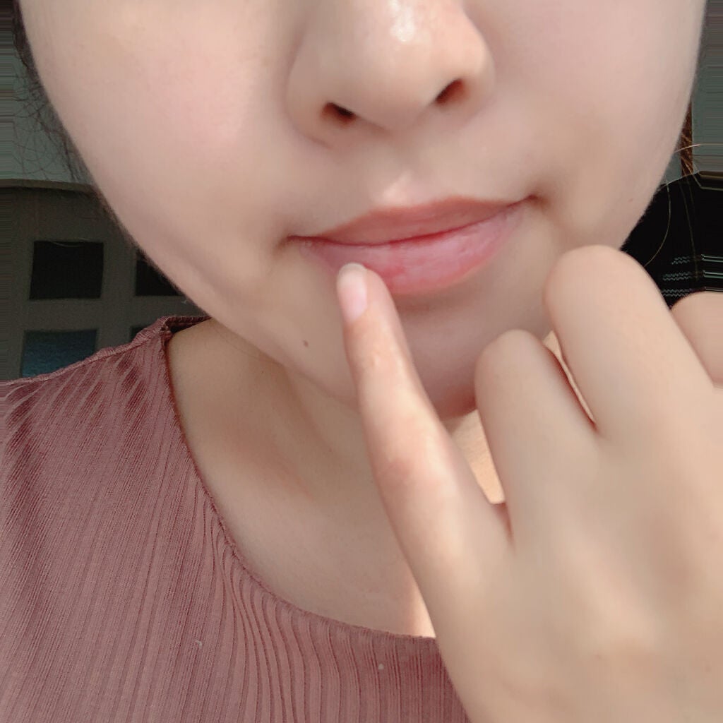 Lip Medex/Blistex/リップバームを使ったクチコミ(5枚目)