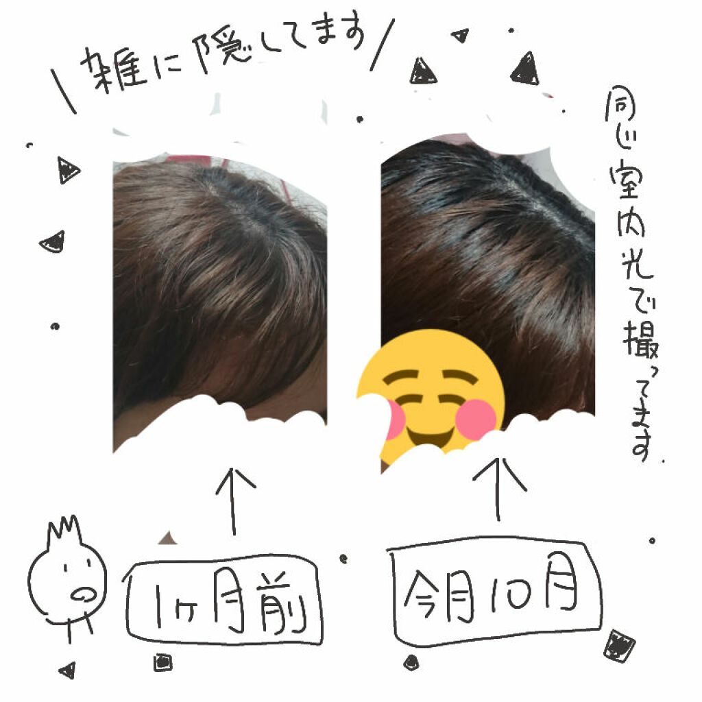 ミラクルズ カラーシャイン シャンプー/トリートメント/パンテーン/市販シャンプーを使ったクチコミ(2枚目)