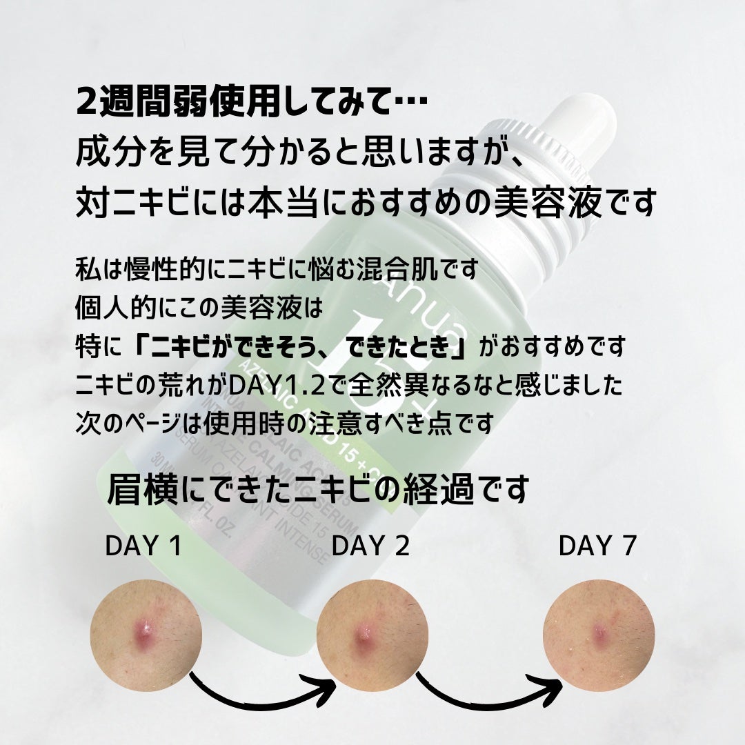 アゼライン酸15 インテンスカーミングセラム/Anua/美容液を使ったクチコミ(3枚目)