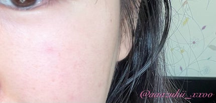 メディプラスゲル/メディプラス/オールインワン化粧品を使ったクチコミ(2枚目)